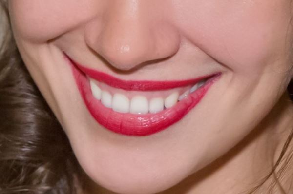 Почему зубы меняют цвет: есть 2 причины – откажитесь от самолечения